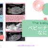babynub ベビーナブってなに？ 男児確定エコーあり