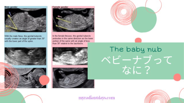 babynub ベビーナブってなに？ 男児確定エコーあり